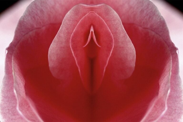 multi-gyn-anatopmia-pochwy